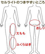 セルライトの原因１　循環機能